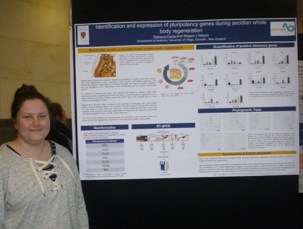 Photo of Rebecca Clarke standing infront of her research poster